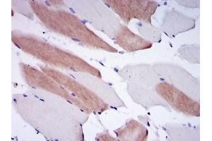 Immunohistochemical analysis of paraffin-embedded human striated muscle tissues using LMNA mouse mAb with DAB staining. (Lamin A/C 抗体)
