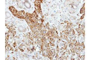 IHC-P Image Immunohistochemical analysis of paraffin-embedded SCM-1 xenograft, using Pancreatic Lipase, antibody at 1:500 dilution. (PNLIP 抗体)