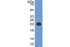 Western Blotting (WB) image for Haptoglobin (HP) ELISA Kit (ABIN6574218)