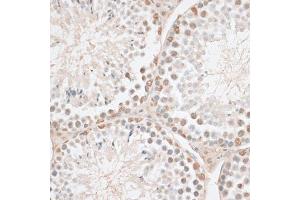 Immunohistochemistry of paraffin-embedded mouse testis using HMGN1 antibody. (HMGN1 抗体)