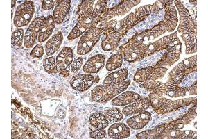 IHC-P Image PKD2 antibody [C1C3] detects PKD2 protein at cytosol and membrane on mouse intestine by immunohistochemical analysis. (PKD2 抗体)
