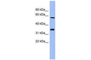 Image no. 1 for anti-Headcase Homolog (HECA) (AA 359-408) antibody (ABIN6744096) (HECA 抗体  (AA 359-408))
