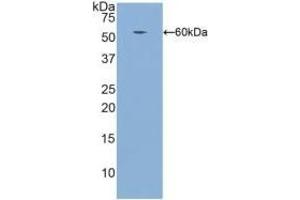 Detection of Recombinant ITGb1, Human using Polyclonal Antibody to Integrin Beta 1 (ITGb1) (ITGB1 抗体  (AA 140-383))