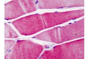 Human Skeletal Muscle: Formalin-Fixed, Paraffin-Embedded (FFPE) (ACTN3 抗体  (N-Term))