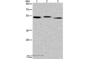 Western blot analysis of Human kidney tissue, HepG2 cell and human testis tissue, using HYAL3 Polyclonal Antibody at dilution of 1:400 (HYAL3 抗体)