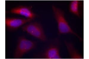 Image no. 3 for anti-Eukaryotic Translation Initiation Factor 2-alpha Kinase 2 (EIF2AK2) (pThr446) antibody (ABIN197048) (EIF2AK2 抗体  (pThr446))