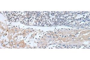 Immunohistochemistry of paraffin-embedded Human tonsil tissue using ABR Polyclonal Antibody at dilution of 1:50(x200) (ABR 抗体)
