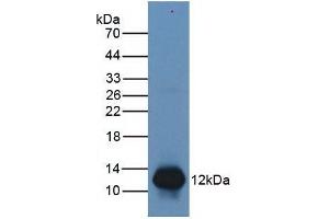 Mouse Capture antibody from the kit in WB with Positive Control: Human Lymphocyte lysate. (S100A8 ELISA 试剂盒)