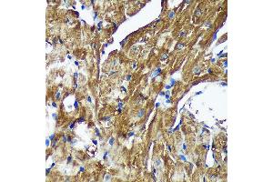 Immunohistochemistry of paraffin-embedded Mouse heart using [KO Validated] NSDHL Rabbit pAb (ABIN7268794) at dilution of 1:100 (40x lens). (NSDHL 抗体  (AA 1-240))