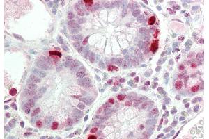 Rabbit Anti-RAPGEF2 antibody  Formalin Fixed Paraffin Embedded Tissue: Human Small Intestine Primary antibody Concentration: 1:100 Secondary Antibody: Donkey anti-Rabbit-Cy3 Secondary Antibody Concentration: 1:200 Magnification: 20x Exposure Time: 0. (RAPGEF2 抗体  (C-Term))