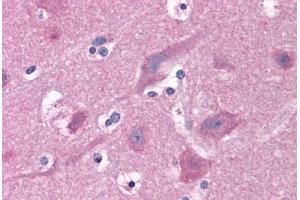 Human Brain, Cortex: Formalin-Fixed, Paraffin-Embedded (FFPE) (PAK1 抗体  (AA 245-490))