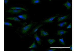 Immunofluorescence of purified MaxPab antibody to EIF4B on HeLa cell. (EIF4B 抗体  (AA 1-611))