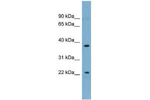 WB Suggested Anti-FOXN4 Antibody Titration:  0. (FOXN4 抗体  (Middle Region))