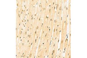 Immunohistochemistry of paraffin embedded rat heart using CITED4 (ABIN7073356) at dilution of 1:2200 (400x lens)
