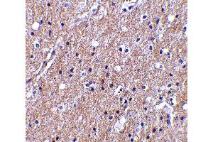 Immunohistochemistry (IHC) image for anti-Complement C1q Tumor Necrosis Factor-Related Protein 6 (C1QTNF6) (Middle Region) antibody (ABIN1030915) (CTRP6 抗体  (Middle Region))