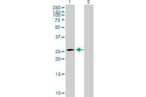 Lane 1: CIDEA transfected lysate ( 28. (CIDEA 293T Cell Transient Overexpression Lysate(Denatured))