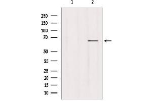 Western blot analysis of extracts from hepg2, using USP39 antibody. (USP39 抗体  (N-Term))