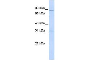 POMT1 antibody used at 1 ug/ml to detect target protein. (POMT1 抗体  (Middle Region))