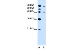 ZFYVE27 antibody used at 2. (ZFYVE27 抗体  (C-Term))