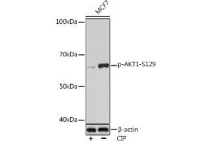 Western blot analysis of extracts of MCF7 cells, using Phospho--S129 Rabbit mAb (ABIN7271246) at 1:1000 dilution. (AKT1 抗体  (pSer129))