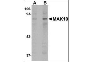 Western blot analysis of MAK10 in mouse heart tissue lysate with this product at (A) 1 and (B) 2 μg/ml. (MAK10/NAA35 抗体  (Center))