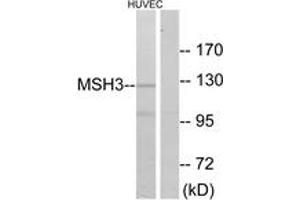 Western blot analysis of extracts from HuvEc cells, using MSH3 Antibody. (MSH3 抗体  (AA 51-100))