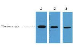 Western Blotting (WB) image for anti-T7-Tag antibody (ABIN3181085) (T7-Tag 抗体)