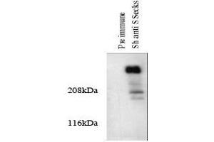 Western blotting total cellular protein from cultured rat aortic smooth muscle cells was prepared and analyze. (AKAP12 抗体)