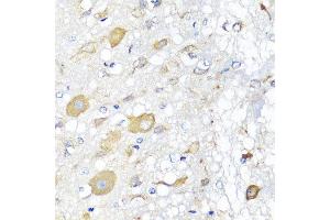 Immunohistochemistry of paraffin-embedded rat brain using CALHM1 antibody at dilution of 1:100 (x40 lens). (CALHM1 抗体)