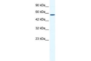 BTBD15 antibody used at 0. (ZBTB44 抗体  (C-Term))