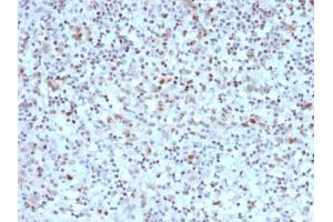 Immunohistochemistry (IHC) image for anti-B-Cell CLL/lymphoma 6 (BCL6) (AA 256-389) antibody (ABIN6940529)