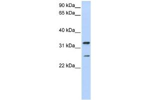 KCNIP2 抗体  (N-Term)