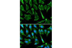 anti-Breast Cancer 1 (BRCA1) (AA 120-220) antibody