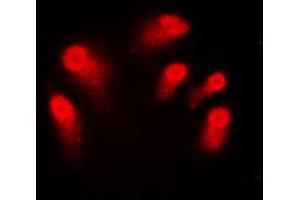 Immunofluorescent analysis of AIRE staining in Jurkat cells. (AIRE 抗体  (Center))