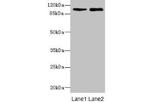 Western blot All lanes: GRIK3 antibody at 1. (GRIK3 抗体  (AA 32-240))