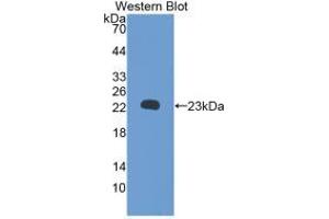 Western blot analysis of recombinant Rat RBP5. (Retinol Binding Protein 5 抗体  (AA 19-201))