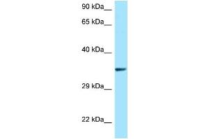 WB Suggested Anti-QKI AntibodyTitration: 1. (QKI 抗体  (N-Term))