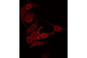 ABIN6274849 staining Hela by IF/ICC. (ANGPTL7 抗体  (C-Term))