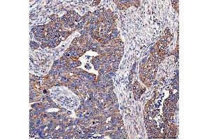 IHC analysis of EML4 using anti-EML4 antibody (ABIN6719384).