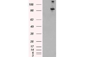 HEK293 overexpressing Human TSC1 and probed with ABIN2562994 (mock transfection in first lane). (TSC1 抗体  (C-Term, Isoform 1))