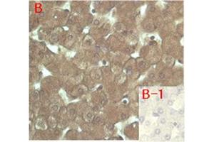 Immunohistochemical staining of human tissue using anti-FGF-23 (human), mAb (FG322-3)  at 1:200 dilution. (FGF23 抗体)