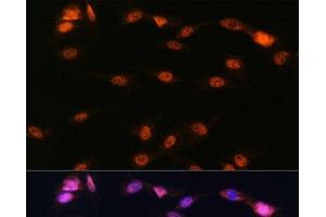 Immunofluorescence analysis of C6 cells using ALOX5 Polyclonal Antibody at dilution of 1:100. (ALOX5 抗体)