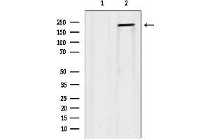 Western blot analysis of lysates from Hela, using Collagen V α1 Antibody.