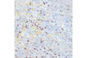 Immunohistochemistry (IHC) image for anti-Neural Precursor Cell Expressed, Developmentally Down-Regulated 9 (NEDD9) (AA 60-174) antibody (ABIN3023331)