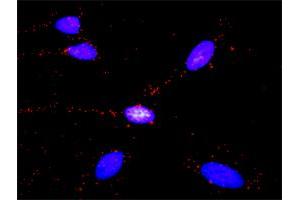 Proximity Ligation Analysis of protein-protein interactions between SMAD1 and GLI3. (GLI3 抗体  (AA 1-110))