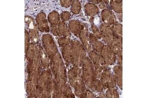 Immunohistochemical staining of human stomach with RCCD1 polyclonal antibody  shows distinct cytoplasmic and nuclear positivity in glandular cells at 1:50-1:200 dilution. (RCCD1 抗体)
