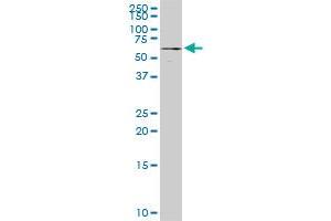 ALG12 monoclonal antibody (M06), clone 5E3. (ALG12 抗体  (AA 369-425))