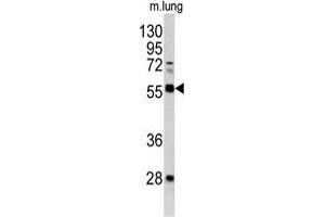 Western blot analysis of FLI1 antibody (Center) in mouse lung tissue lysates(35 µg/lane). (FLI1 抗体  (Middle Region))