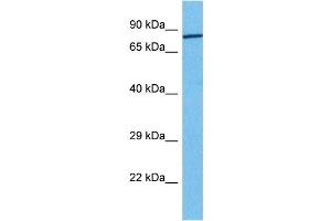 Host:  Rabbit  Target Name:  FOXM1  Sample Tissue:  Human 786-0 Whole Cell  Antibody Dilution:  1ug/ml (FOXM1 抗体  (Middle Region))
