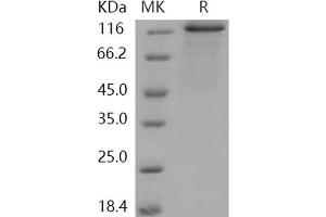 Western Blotting (WB) image for Protein Kinase D2 (PKD2) (Active) protein (GST tag,His tag) (ABIN7317066) (PKD2 Protein (GST tag,His tag))